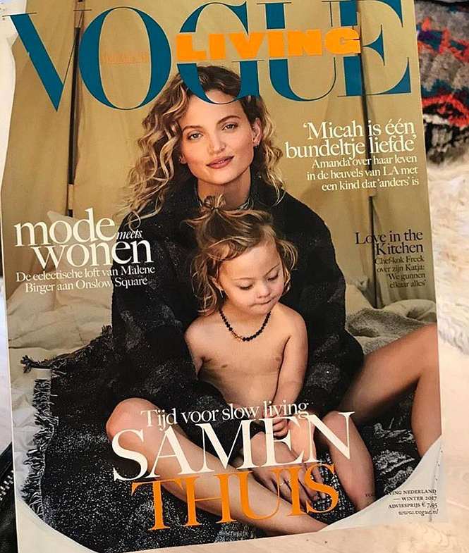 Un mannequin et son fils trisomique en Une de Vogue
